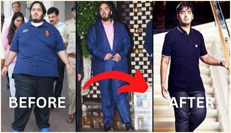 Anant Ambani's Journey: Battling A Rare Disease With Courage